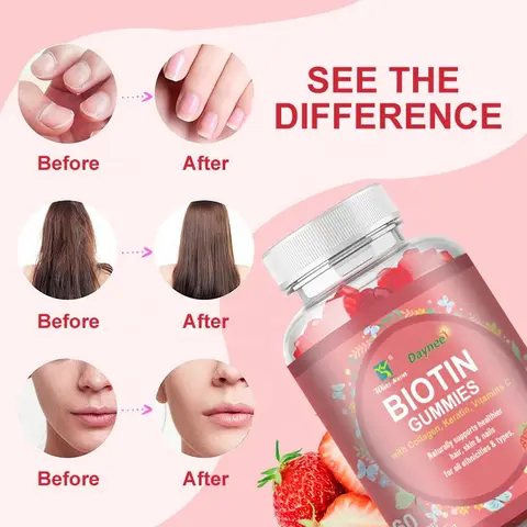 Bioten Gummies – Votre allié bien-être au quotidien